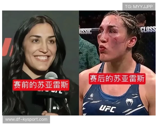 UFC选手破防后一套组合结束对手:从破防到终结的瞬间艺术 UFC选手破防后一套组合结束对手:从破防到终结的瞬间艺术